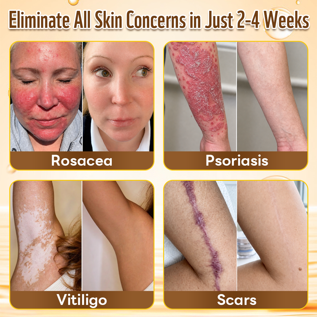 2026 New & Upgraded: 30% OFF ✅ 𝑯𝑰𝑺𝑲𝑰𝑵® Multi-Concern Skin Repair Cream: Advanced Skin Renewal Formula with Botanical Repair Complex — Supports Skin Barrier Recovery & Hydration — Plus Visible Improvement in Dryness, Uneven Tone, Aging Signs & Skin Texture