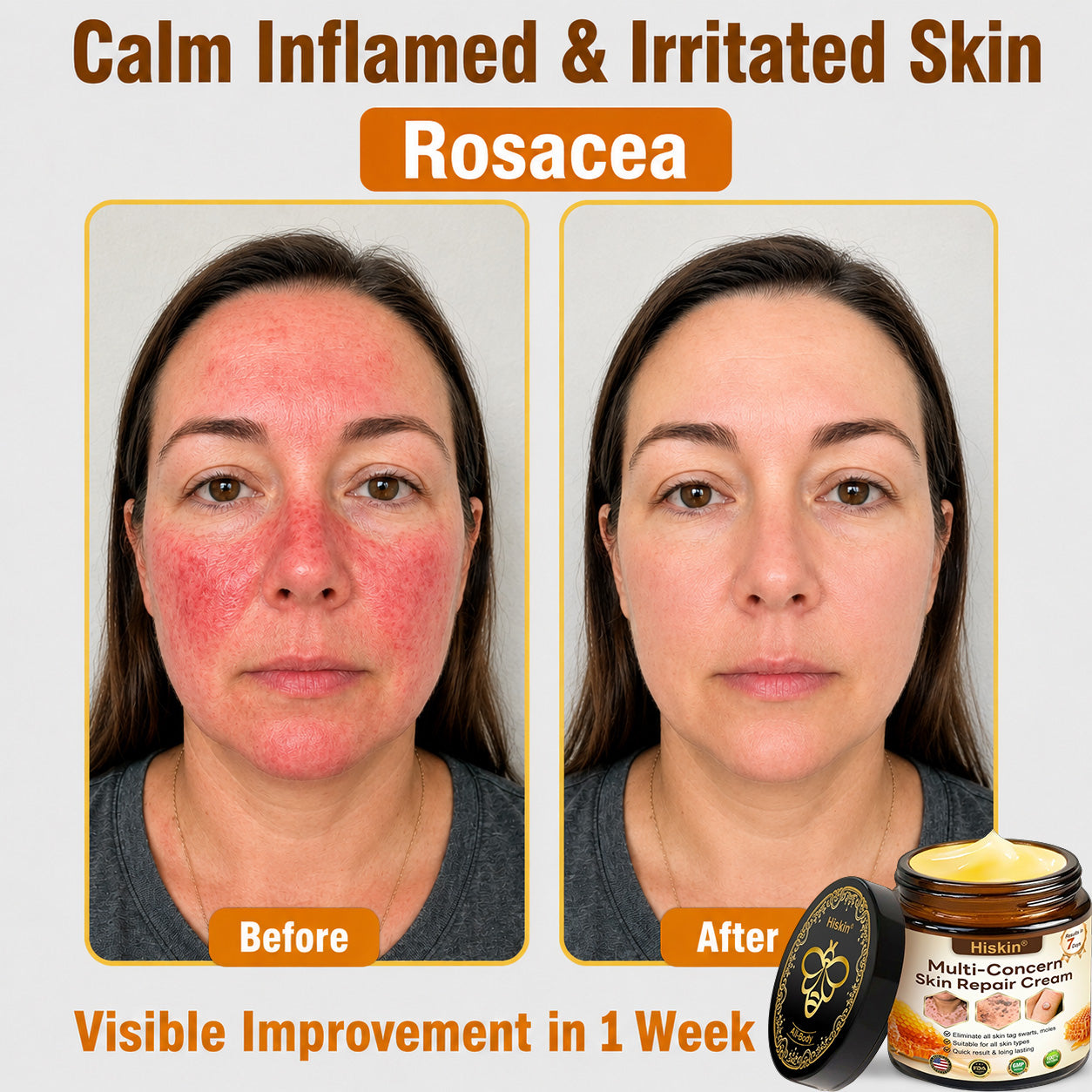 2026 New & Upgraded: 30% OFF ✅ 𝑯𝑰𝑺𝑲𝑰𝑵® Multi-Concern Skin Repair Cream: Advanced Skin Renewal Formula with Botanical Repair Complex — Supports Skin Barrier Recovery & Hydration — Plus Visible Improvement in Dryness, Uneven Tone, Aging Signs & Skin Texture