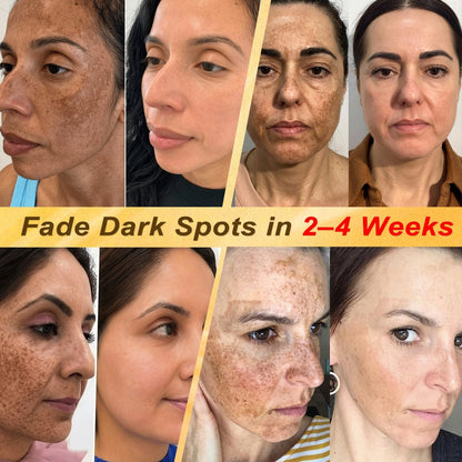 2026 New & Upgraded: 30% OFF ✅ 𝑯𝑰𝑺𝑲𝑰𝑵® Multi-Concern Skin Repair Cream: Advanced Skin Renewal Formula with Botanical Repair Complex — Supports Skin Barrier Recovery & Hydration — Plus Visible Improvement in Dryness, Uneven Tone, Aging Signs & Skin Texture