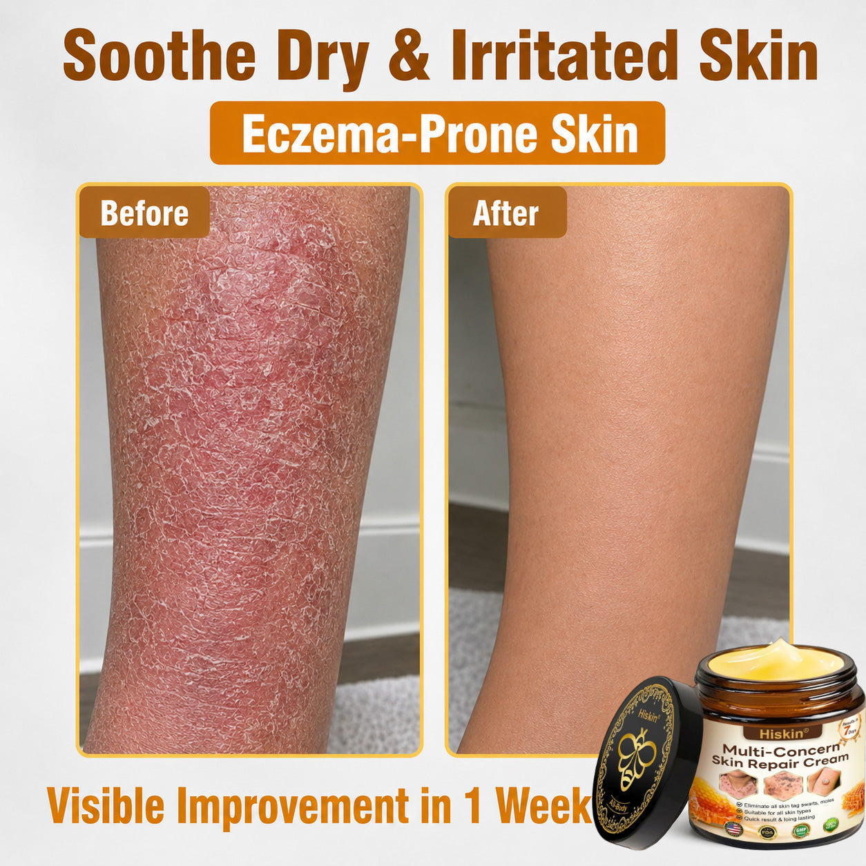 2026 New & Upgraded: 30% OFF ✅ 𝑯𝑰𝑺𝑲𝑰𝑵® Multi-Concern Skin Repair Cream: Advanced Skin Renewal Formula with Botanical Repair Complex — Supports Skin Barrier Recovery & Hydration — Plus Visible Improvement in Dryness, Uneven Tone, Aging Signs & Skin Texture