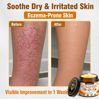 2026 New & Upgraded: 30% OFF ✅ 𝑯𝑰𝑺𝑲𝑰𝑵® Multi-Concern Skin Repair Cream: Advanced Skin Renewal Formula with Botanical Repair Complex — Supports Skin Barrier Recovery & Hydration — Plus Visible Improvement in Dryness, Uneven Tone, Aging Signs & Skin Texture