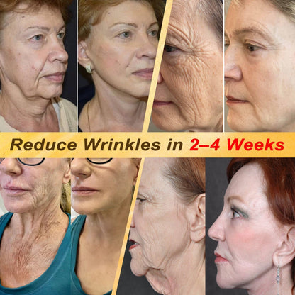2026 New & Upgraded: 30% OFF ✅ 𝑯𝑰𝑺𝑲𝑰𝑵® Multi-Concern Skin Repair Cream: Advanced Skin Renewal Formula with Botanical Repair Complex — Supports Skin Barrier Recovery & Hydration — Plus Visible Improvement in Dryness, Uneven Tone, Aging Signs & Skin Texture